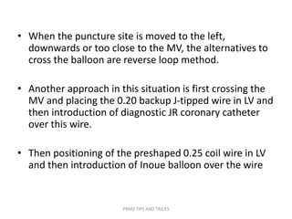 • When the puncture site is moved to the left,
downwards or too close to the MV, the alternatives to
cross the balloon are reverse loop method.
• Another approach in this situation is first crossing the
MV and placing the 0.20 backup J-tipped wire in LV and
then introduction of diagnostic JR coronary catheter
over this wire.
• Then positioning of the preshaped 0.25 coil wire in LV
and then introduction of Inoue balloon over the wire
PBMV TIPS AND TRICKS
 