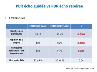 PBR écho guidée vs PBR écho repérée
• 129 biopsies
ÉCHO GUIDAGE ECHO REPÉRAGE p
Nombre des
glomérules 18 ±9 11 ±9 0.0001
Répition de la
biopsie 0 % 16 % 0.0006
Hématome
nécissitant une
intervention
0 % 11 % 0.006
Hct après 24h 32 ±5 % 30 ±4 % 0.04
Semin Dial. 2007 Jul-Aug;20 (4) :355-8
 