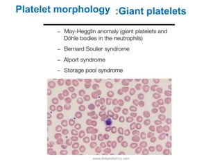 :Giant plateletsPlatelet morphology
www.dnbpediatrics.com
 