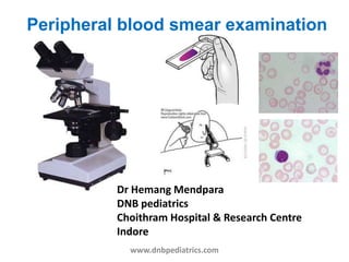 Peripheral blood smear examination
Dr Hemang Mendpara
DNB pediatrics
Choithram Hospital & Research Centre
Indore
www.dnbpediatrics.com
 