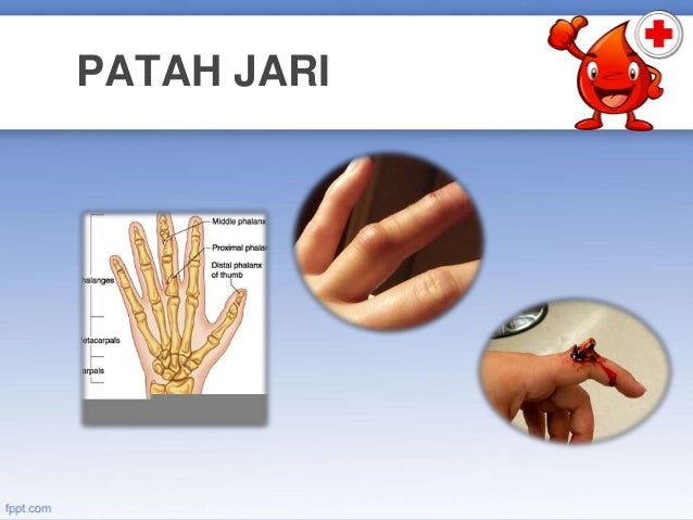 Pbsm 2012 Patah Dan Terseliuh