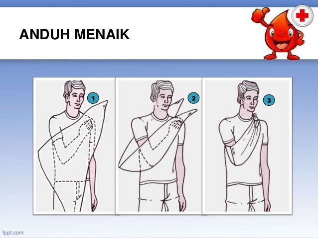 Cara Membalut Patah Tulang Bahu – Eva