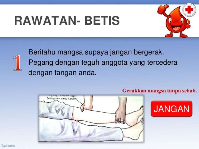 Image Result For Cedera Betis Image Result For Cedera Betis