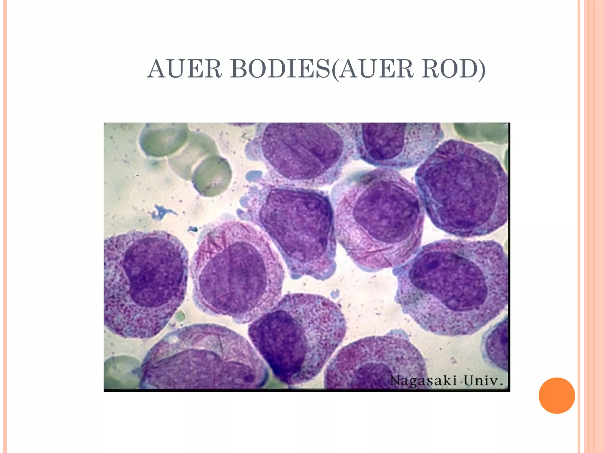 Peripheral blood Smear Preparation | PPT