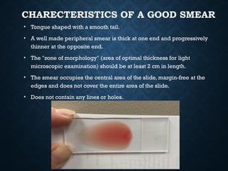 Good Smear Example PBS preparation, staining interpretation- Briefing.pptx