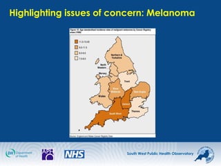 South West Public Health Observatory
Highlighting issues of concern: Melanoma
 