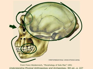 From Franz Weidenreich, “Morphology of Solo Man” 1951 Understanding Physical Anthropology and Archaeology, 9th ed.,  p. 227 