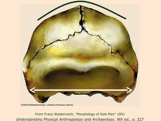 From Franz Weidenreich, “Morphology of Solo Man” 1951 Understanding Physical Anthropology and Archaeology, 9th ed.,  p. 227 