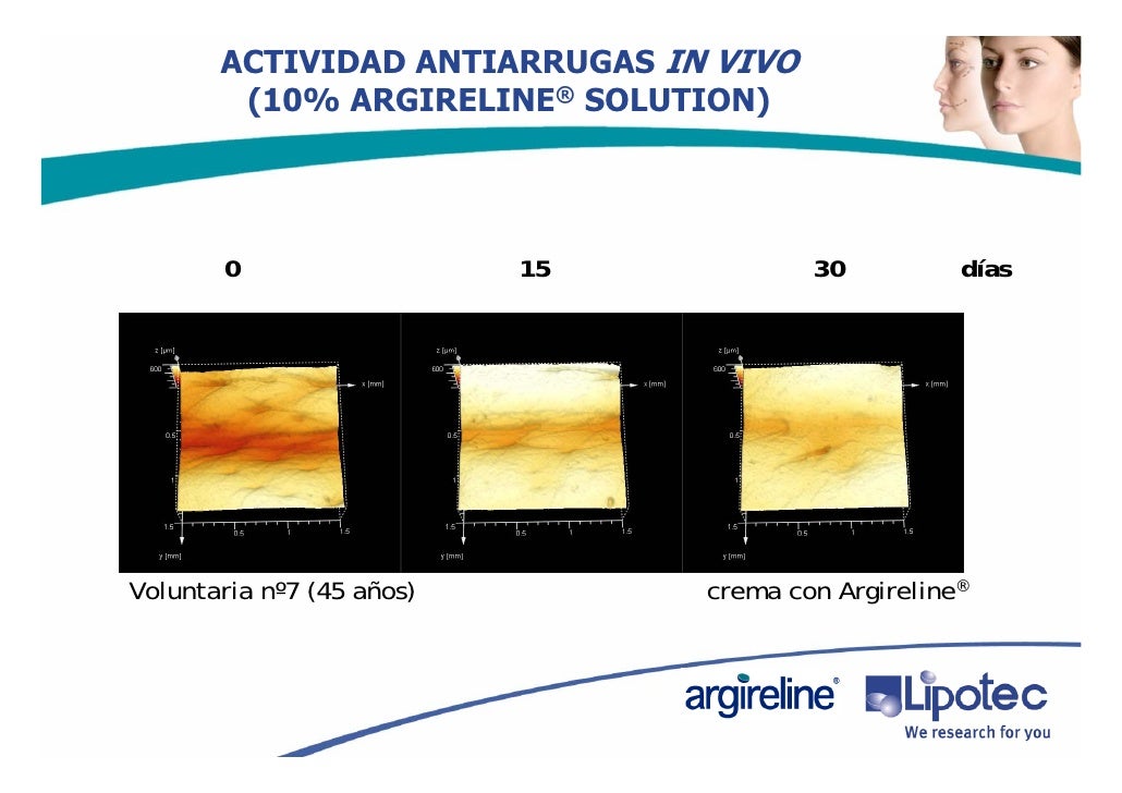 Los hinchazones alrededor de los ojos la rubefacción