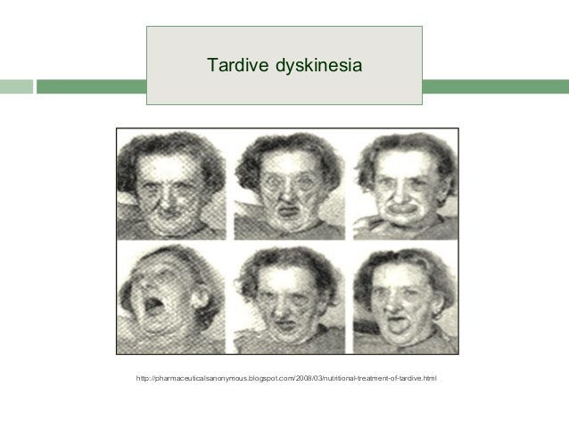 treatment for tardive dyskinesia from haldol