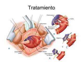 Tratamiento 