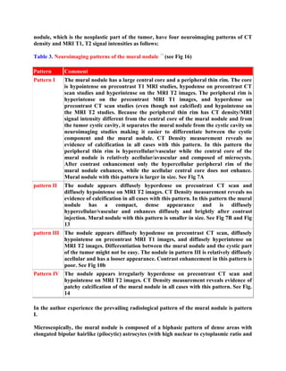 Topic of the month: Radiological pathology of pilocytic astrocytoma | PDF