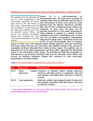 Topic of the month: Radiological pathology of pilocytic astrocytoma | PDF