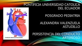 PONTIFICIA UNIVERSIDAD CATOLICA
DEL ECUADOR
POSGRADO PEDIATRIA
ALEXANDRA VALENZUELA
ASTUDILLO
PERSISTENCIA DEL CONDUCTO
ARTERIOSO
 