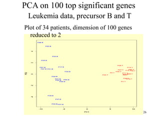 26
PCA on 100 top significant genes
Leukemia data, precursor B and T
Plot of 34 patients, dimension of 100 genes
reduced to 2
 
