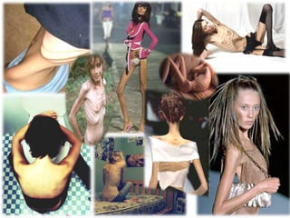 Perda de interesse pelas actividades habituais