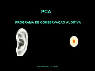 PCA
PROGRAMA DE CONSERVAÇÃO AUDITIVA
Devânia Silva - TST / EIM
 