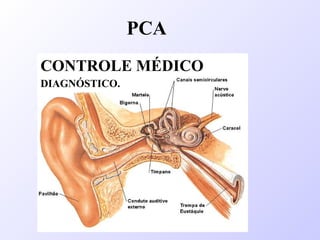 PCA
CONTROLE MÉDICO
DIAGNÓSTICO.
 