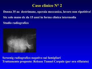 Caso clinico N° 2
Donna 35 aa destrimane, operaia meccanica, lavoro non ripetitivo!
Stc solo mano dx da 15 anni in forma clinica intermedia
Studio radiografico

Screenig radiografico negativo sui famigliari
Trattamento proposto: Release Tunnel Carpale (per ora rifiutato)

 