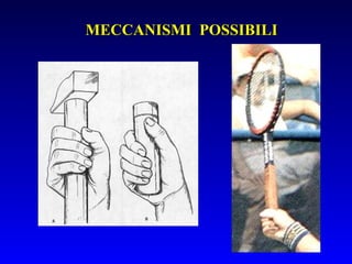 MECCANISMI POSSIBILI

 