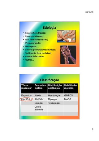 03/10/15
3
E/ologia	
  
•  Fatores	
  hereditários;	
  
•  Fatores	
  maternos;	
  
•  Mal	
  formações	
  no	
  SNC;	
  
•  Prematuridade;	
  
•  Baixo	
  peso;	
  
•  Fatores	
  perinatais	
  traumá/cos;	
  
•  Sofrimento	
  fetal	
  (anóxias);	
  
•  Fatores	
  infecciosos;	
  
•  Outros...	
  
Classiﬁcação	
  
Tônus
muscular
Desordem
motora
Distribuição
anatômica
Habilidades
motoras
Espastico Ataxia Hemiplegia GMFCS
Hipotônico Atetóide Diplegia MACS
Coréica Tetraplegia
Coreo-
atetóide
 