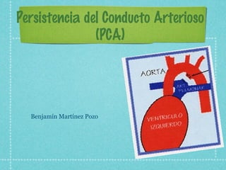 Persistencia del Conducto Arterioso
(PCA)
Benjamín Martínez Pozo
 