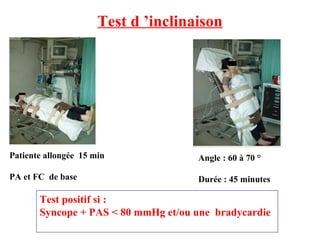 Test d ’inclinaison
Patiente allongée 15 min
PA et FC de base
Angle : 60 à 70 °
Durée : 45 minutes
Test positif si :
Syncope + PAS < 80 mmHg et/ou une bradycardie
 