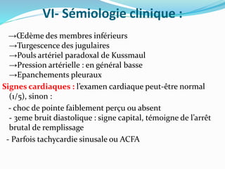 VI- Sémiologie clinique :
→Œdème des membres inférieurs
→Turgescence des jugulaires
→Pouls artériel paradoxal de Kussmaul
→Pression artérielle : en général basse
→Epanchements pleuraux
Signes cardiaques : l’examen cardiaque peut-être normal
(1/5), sinon :
- choc de pointe faiblement perçu ou absent
- 3eme bruit diastolique : signe capital, témoigne de l’arrêt
brutal de remplissage
- Parfois tachycardie sinusale ou ACFA
 