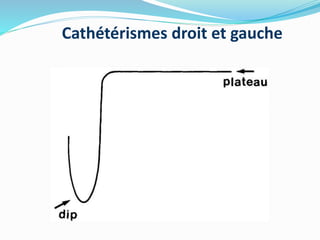 Cathétérismes droit et gauche
 
