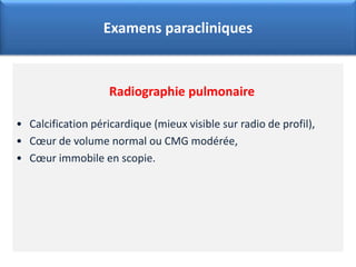 Radiographie pulmonaire
• Calcification péricardique (mieux visible sur radio de profil),
• Cœur de volume normal ou CMG modérée,
• Cœur immobile en scopie.
Examens paracliniques
 