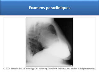 Examens paracliniques
 