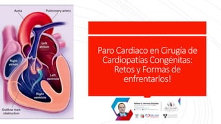 Paro Cardiaco en Cirugía de
CardiopatíasCongénitas:
Retosy Formasde
enfrentarlos!
 