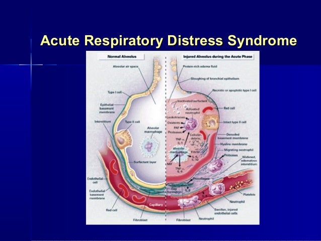the causes characteristics and complications of the severe acute respiratory syndrome What is severe acute respiratory syndrome (sars) what is the cause severe acute respiratory syndrome common respiratory tract infections complications. the causes characteristics and complications of the severe acute respiratory syndrome What is severe acute respiratory syndrome (sars) what is the cause severe acute respiratory syndrome common respiratory tract infections complications.