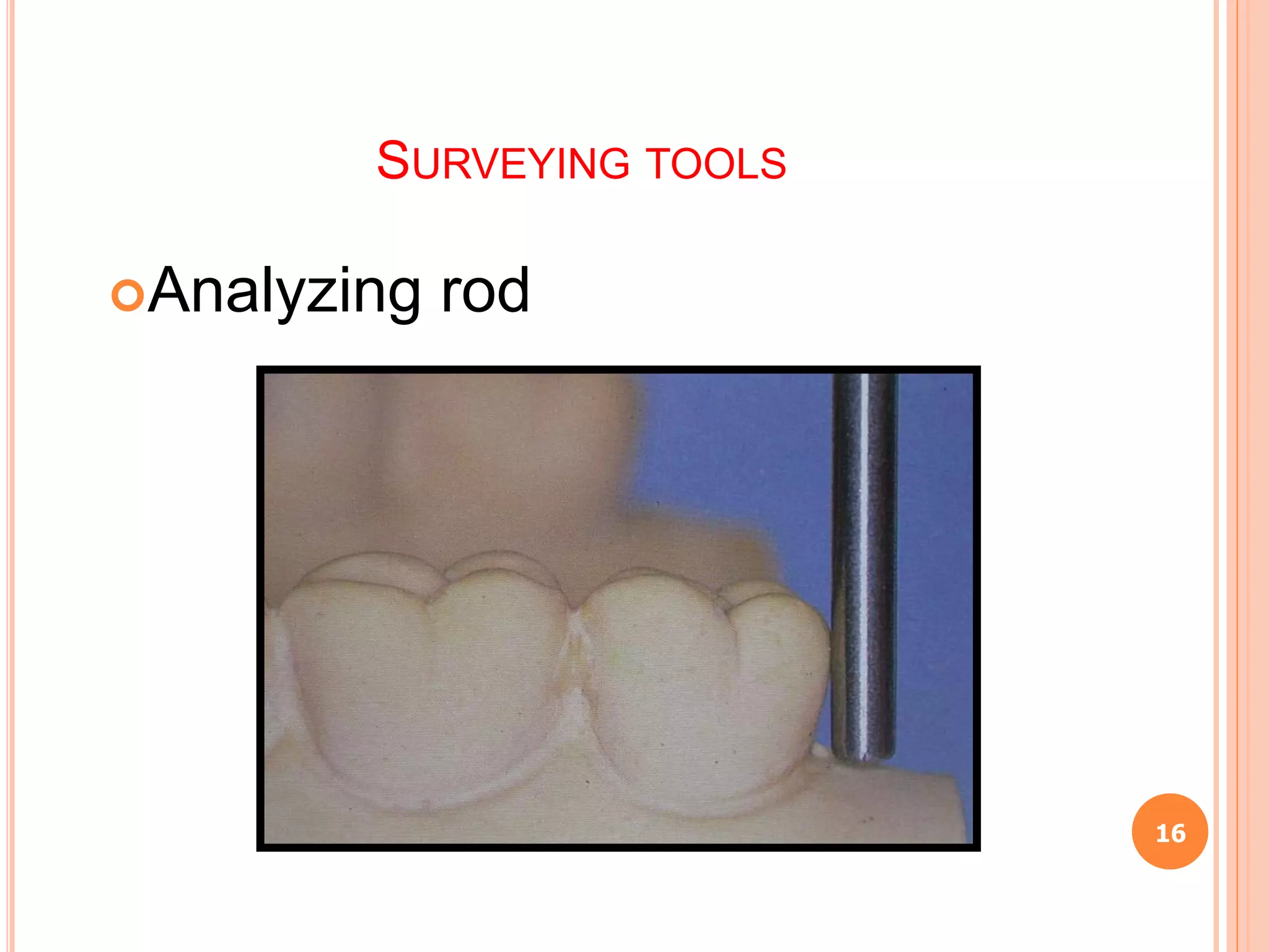 Surveying and Designing in Cast Partial Denture | PPT