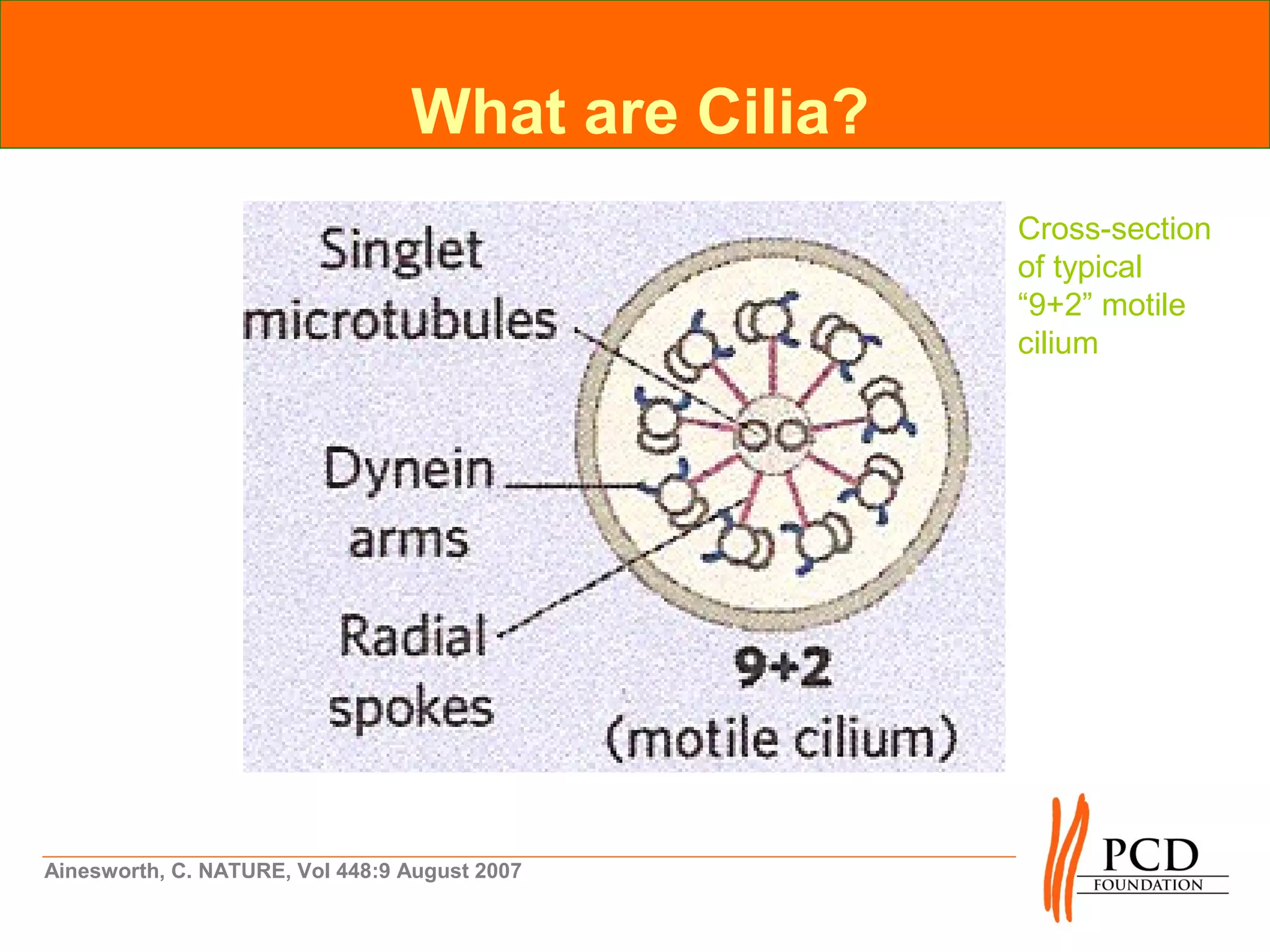 What are Cilia?
                                                   Cross-section
                                                   of typical
                                                   “9+2” motile
                                                   cilium




Ainesworth, C. NATURE, Vol 448:9 August 2007
 