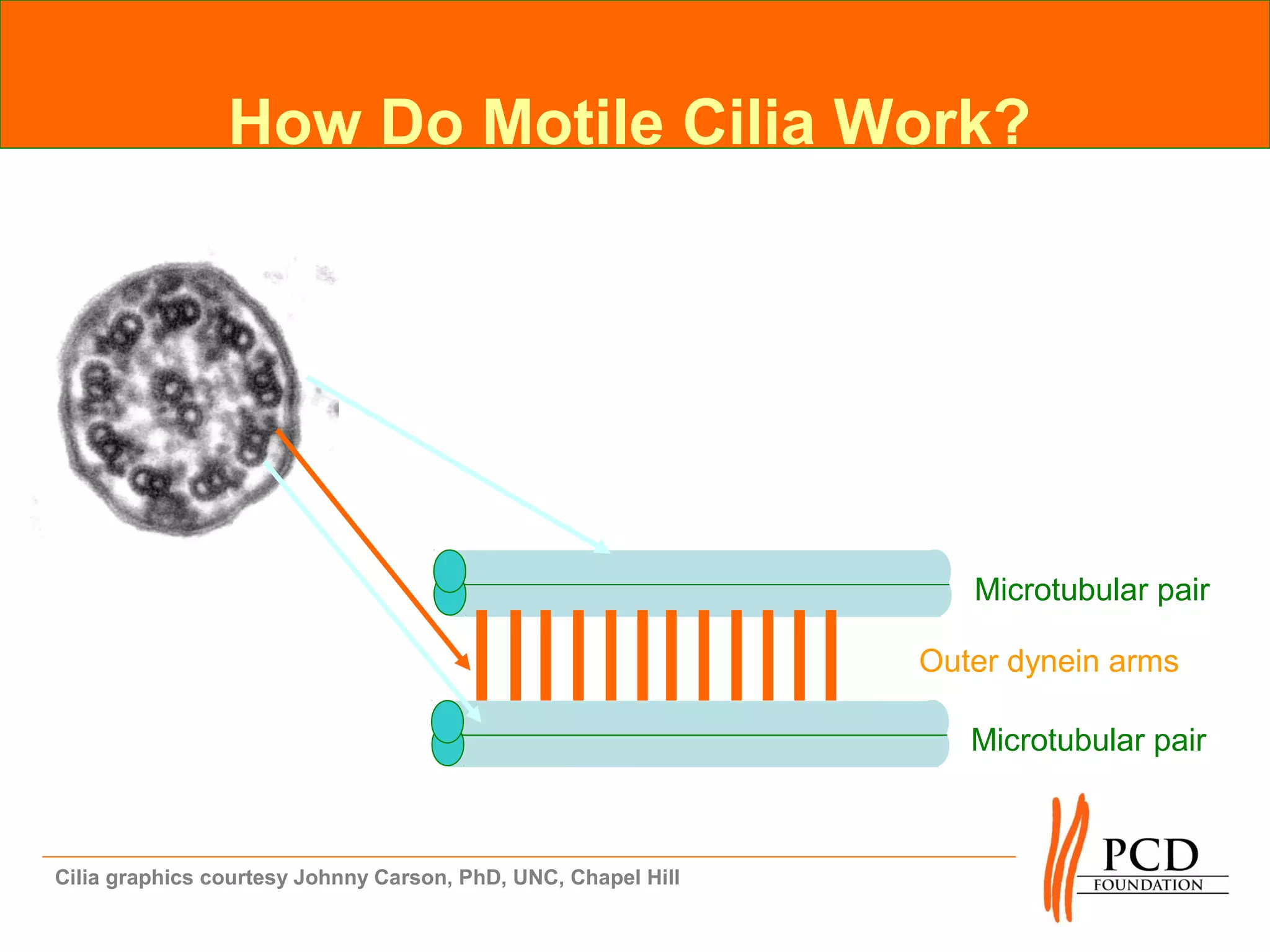How Do Motile Cilia Work?




                                                                  Microtubular pair

                                                               Outer dynein arms

                                                                  Microtubular pair



Cilia graphics courtesy Johnny Carson, PhD, UNC, Chapel Hill
 