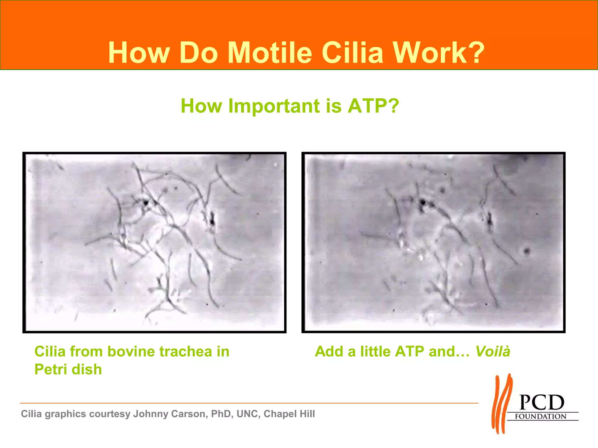 How Do Motile Cilia Work?
                                How Important is ATP?




  Cilia from bovine trachea in                             Add a little ATP and… Voilà
  Petri dish

Cilia graphics courtesy Johnny Carson, PhD, UNC, Chapel Hill
 
