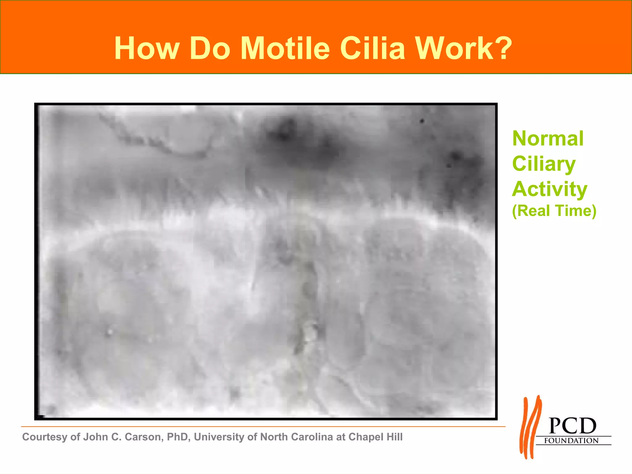 How Do Motile Cilia Work?

                                                                               Normal
                                                                               Ciliary
                                                                               Activity
                                                                               (Real Time)




Courtesy of John C. Carson, PhD, University of North Carolina at Chapel Hill
 