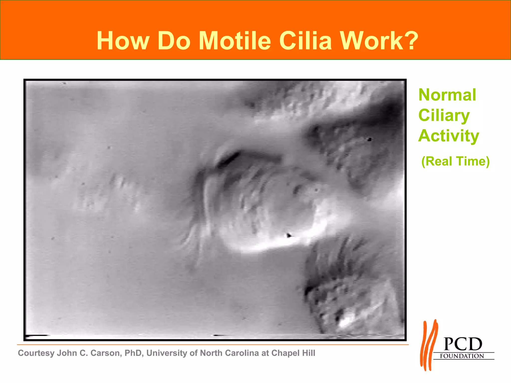 How Do Motile Cilia Work?

                                                                            Normal
                                                                            Ciliary
                                                                            Activity
                                                                            (Real Time)




Courtesy John C. Carson, PhD, University of North Carolina at Chapel Hill
 