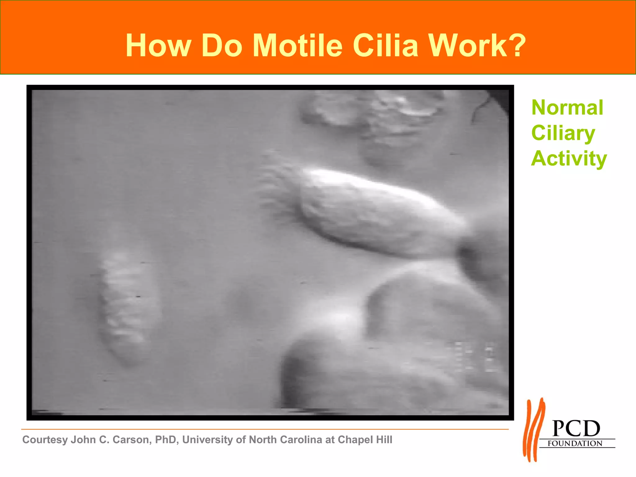 How Do Motile Cilia Work?
                                                                            Normal
                                                                            Ciliary
                                                                            Activity




Courtesy John C. Carson, PhD, University of North Carolina at Chapel Hill
 