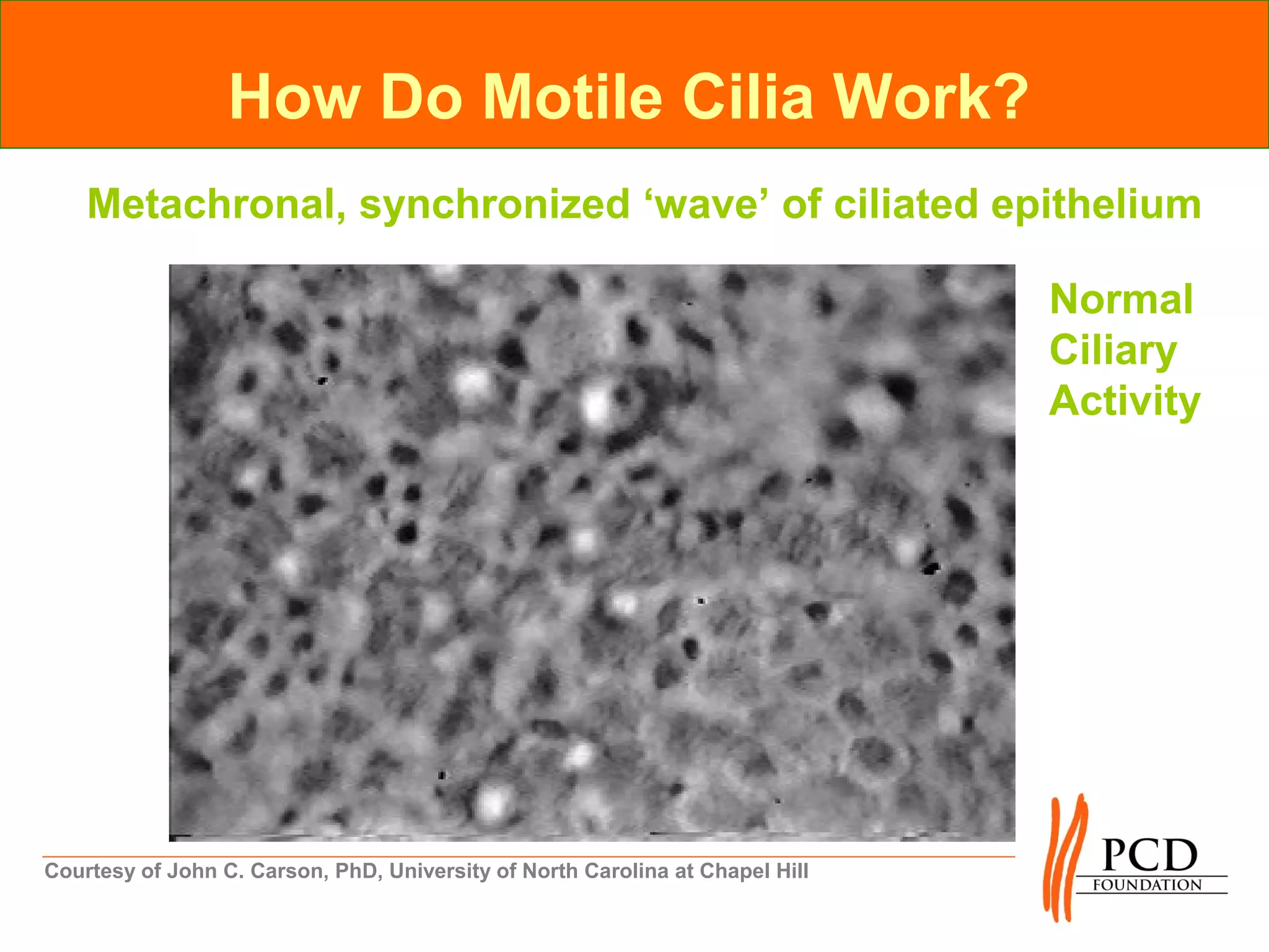 How Do Motile Cilia Work?
    Metachronal, synchronized ‘wave’ of ciliated epithelium

                                                                               Normal
                                                                               Ciliary
                                                                               Activity




Courtesy of John C. Carson, PhD, University of North Carolina at Chapel Hill
 