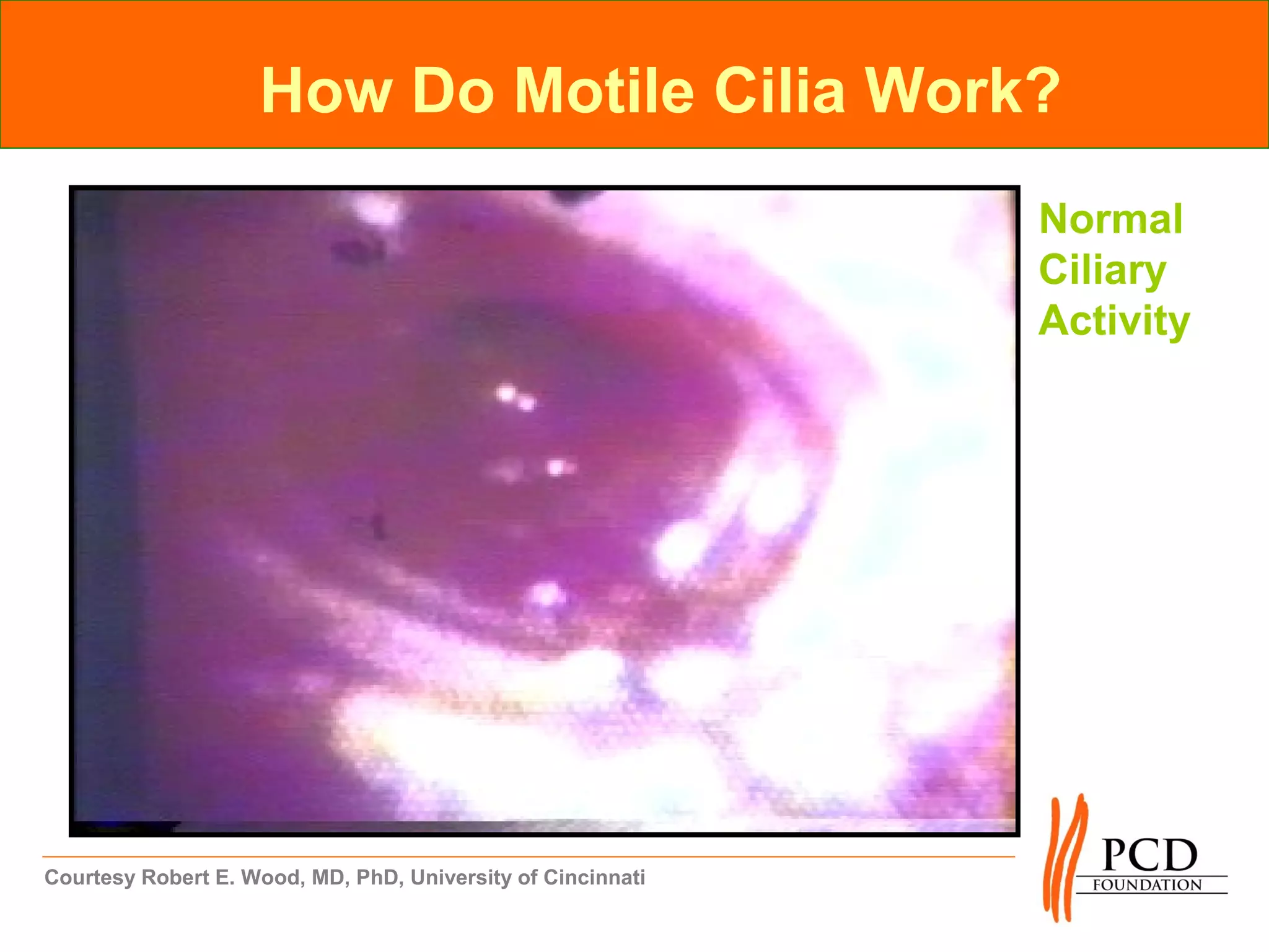 How Do Motile Cilia Work?
                                                             Normal
                                                             Ciliary
                                                             Activity




Courtesy Robert E. Wood, MD, PhD, University of Cincinnati
 