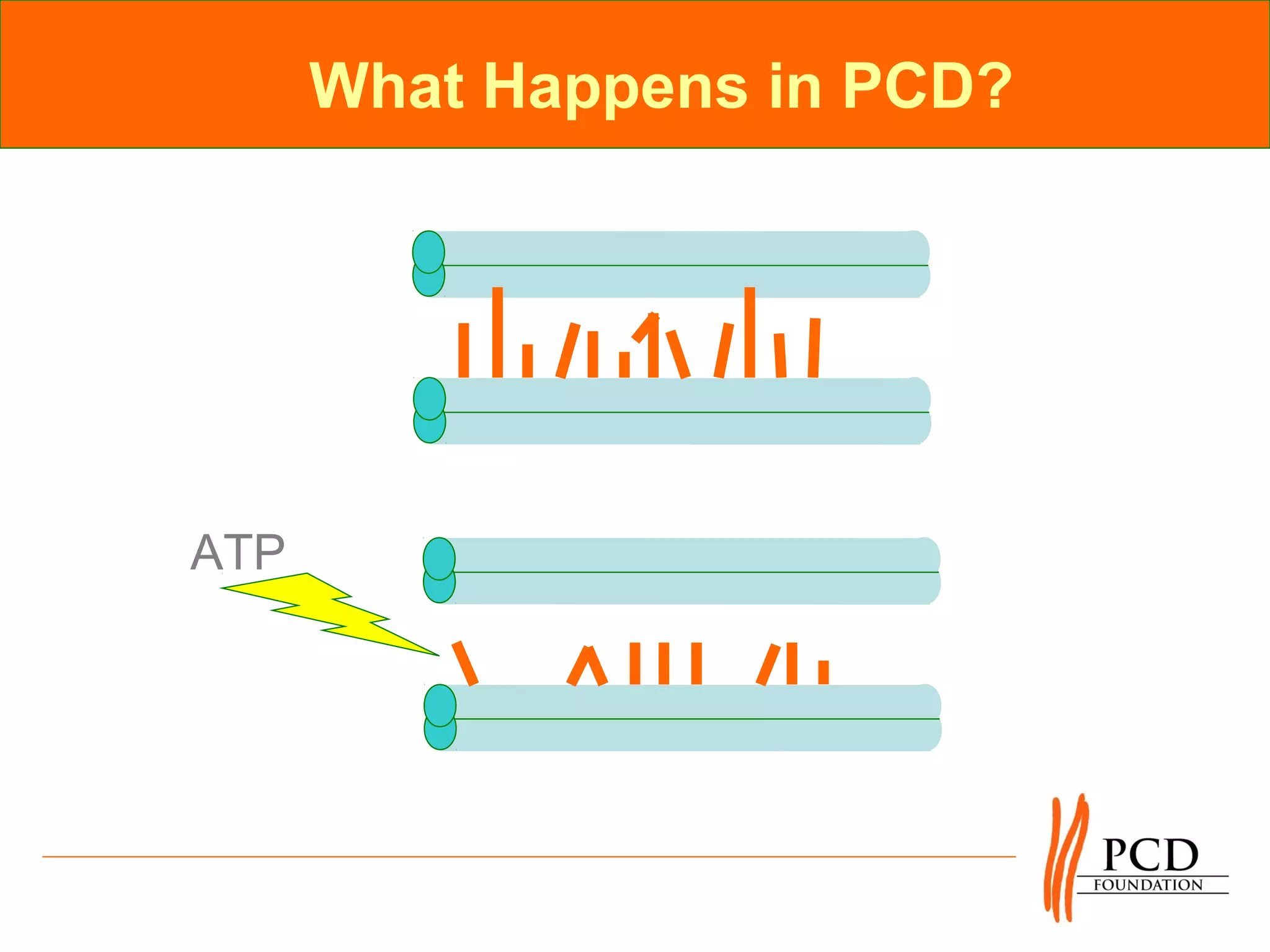 What Happens in PCD?




ATP
 