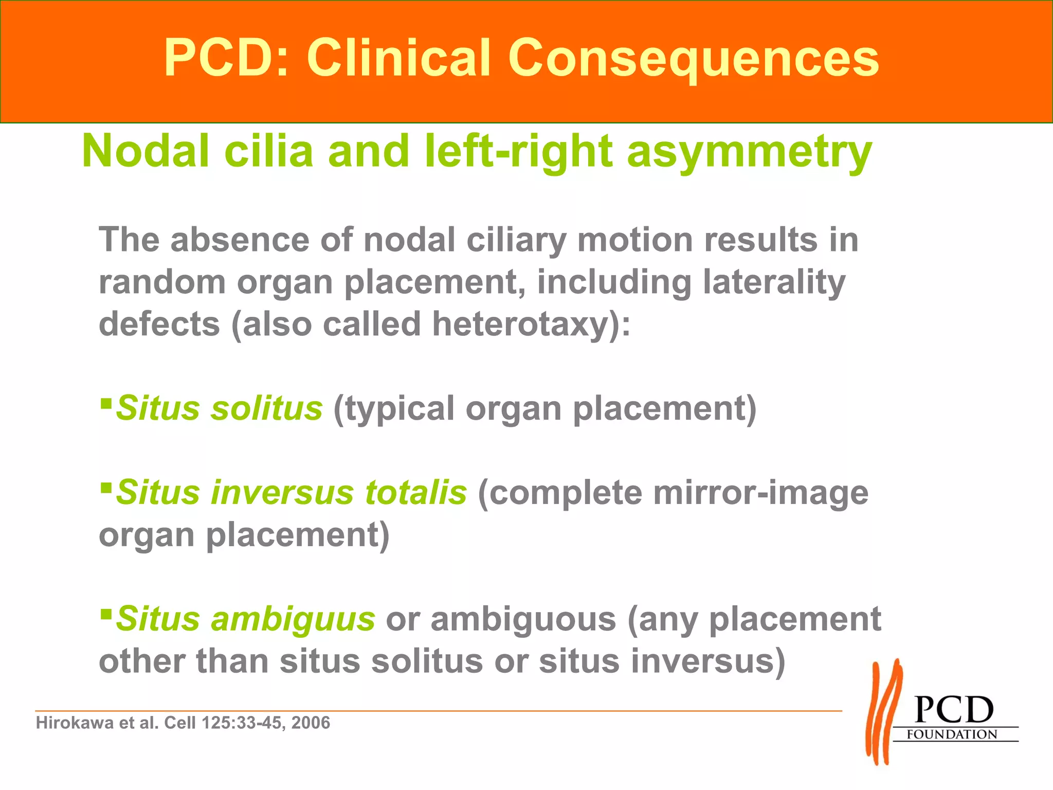 PCD: Clinical Consequences
     Nodal cilia and left-right asymmetry
       The absence of nodal ciliary motion results in
       random organ placement, including laterality
       defects (also called heterotaxy):

       Situs solitus (typical organ placement)

       Situs inversus totalis (complete mirror-image
       organ placement)

       Situs ambiguus or ambiguous (any placement
       other than situs solitus or situs inversus)
Hirokawa et al. Cell 125:33-45, 2006
 