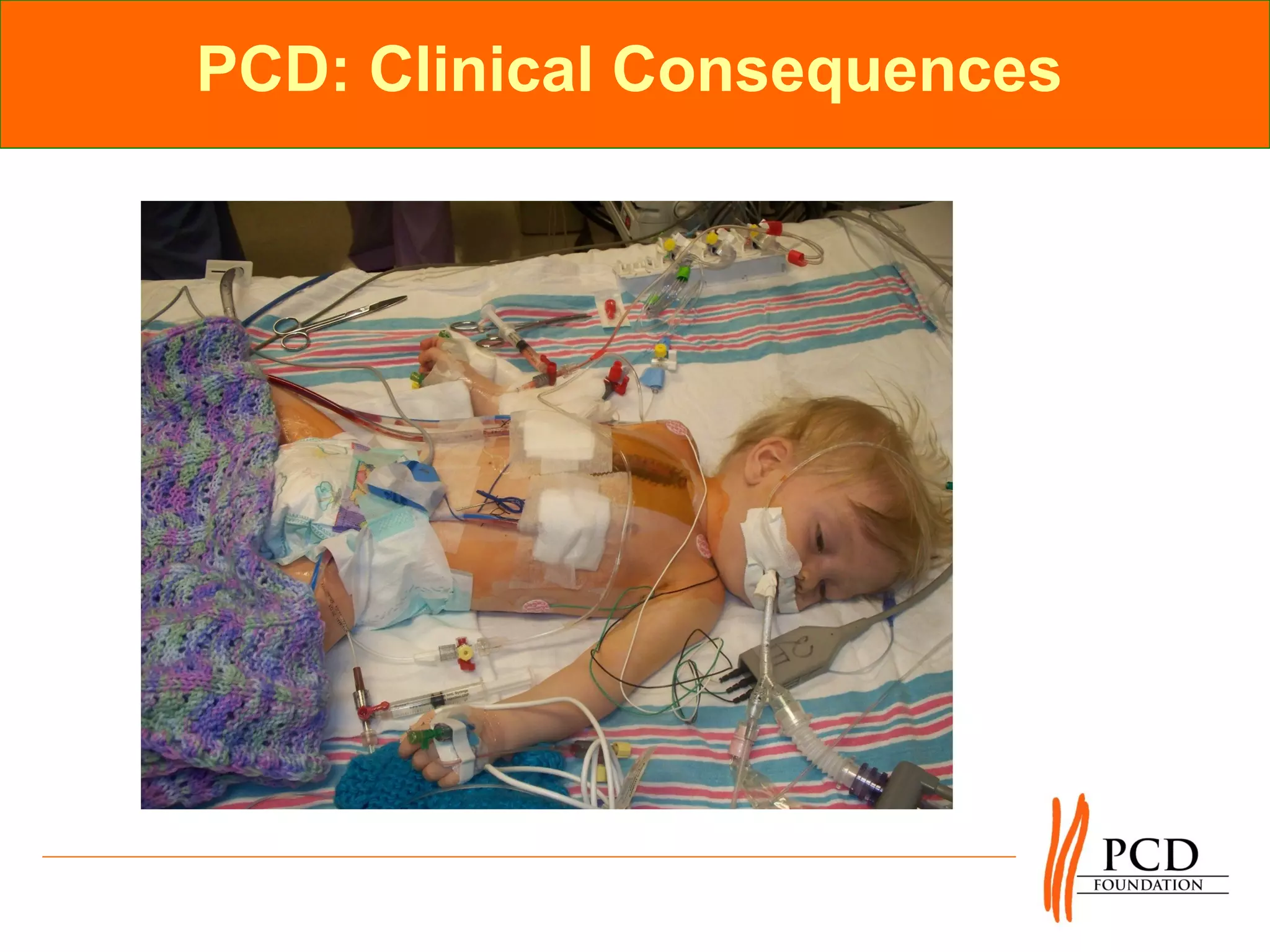 PCD: Clinical Consequences
 