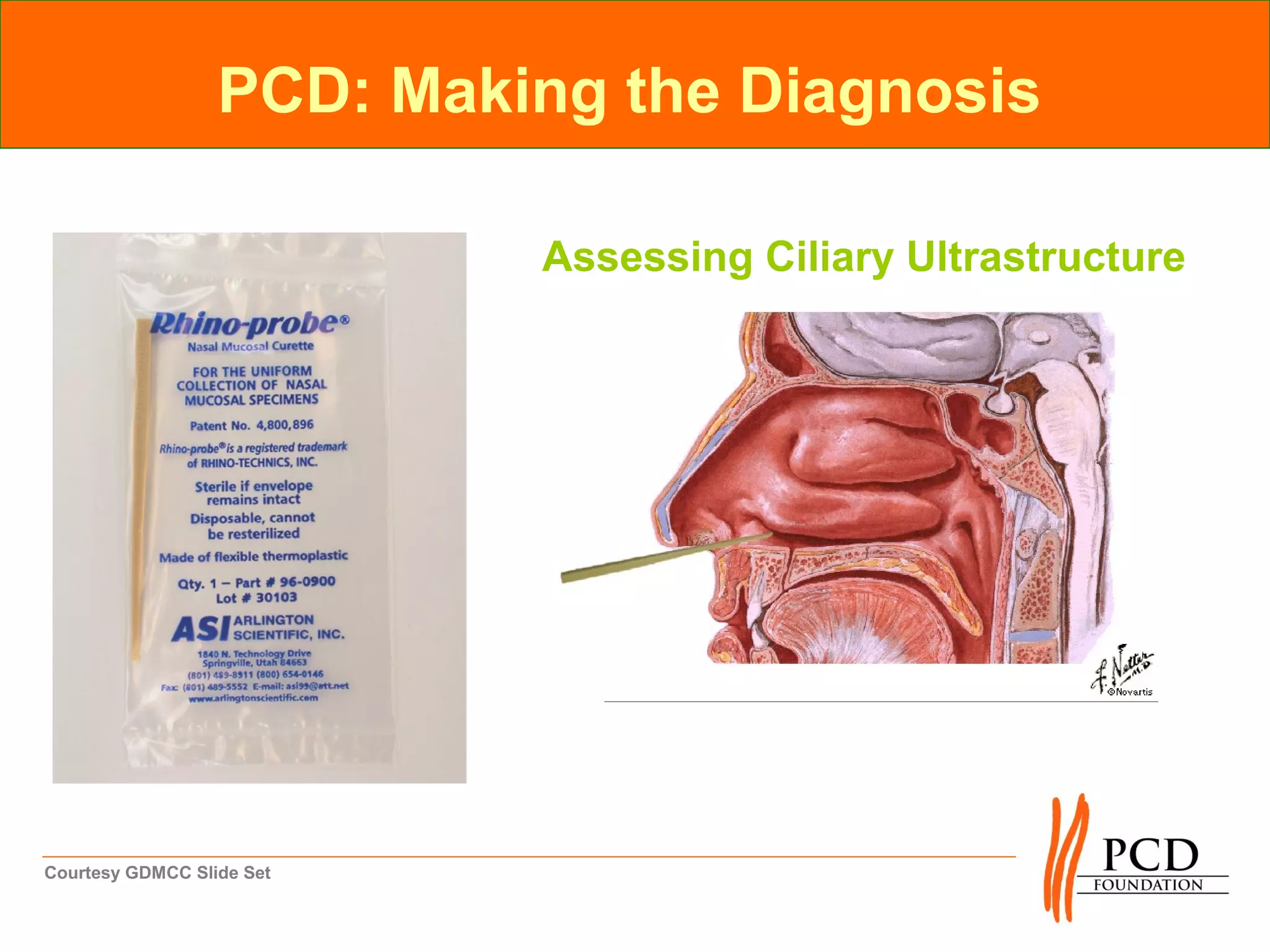 PCD: Making the Diagnosis

                           Assessing Ciliary Ultrastructure




Courtesy GDMCC Slide Set
 