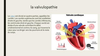 la valvulopathie
Le cœur est divisé en quatre parties, appelées les
cavités. Les cavités supérieures sont les oreillettes
droite et gauche, tandis que les cavités inférieures,
les ventricules droit et gauche.Chaque cavité est
dotée d’une valvule contrôlant le débit
unidirectionnel et continu du sang, qui traverse le
cœur pour se diriger vers les poumons et le reste
du corps.
 