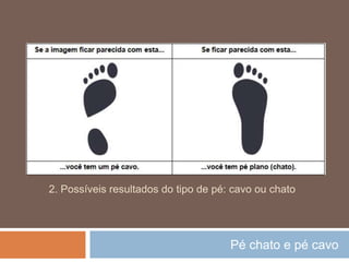 Pé chato e pé cavo
2. Possíveis resultados do tipo de pé: cavo ou chato
 