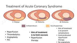 Treatment of Acute Coronary Syndrome
• Reperfusion
• Thrombolytics
• Angioplasty
• PCI
• Aim of treatment
is to limit necrosis
• Reperfusion
therapy
• Aim of treatment
is to prevent
complications
• Contraindicated
reperfusion
therapy
• No angioplasty
 