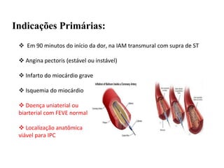 Indicações Primárias:
 Em 90 minutos do início da dor, na IAM transmural com supra de ST
 Angina pectoris (estável ou instável)
 Infarto do miocárdio grave
 Isquemia do miocárdio
 Doença uniaterial ou
biarterial com FEVE normal
 Localização anatômica
viável para IPC
 